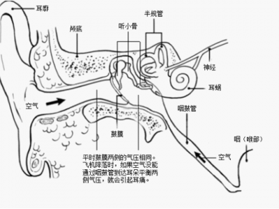 edpm（耳朵平面图）