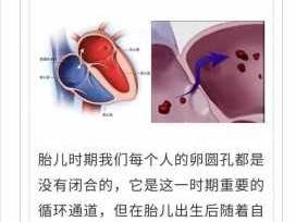 圆孔（圆孔未闭合有什么影响）