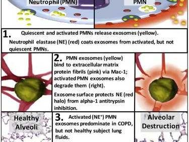 PMN（pmn医学上是什么病）