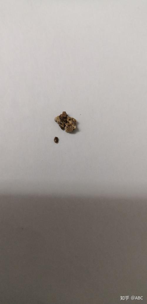 8mm（8mm结石能排出来吗）