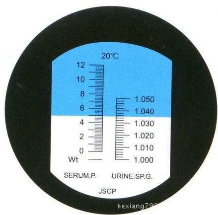 折射仪（折射仪法测定尿液比重的优缺点）