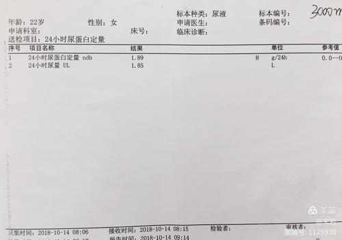 排出量（正常人24h蛋白排出量）