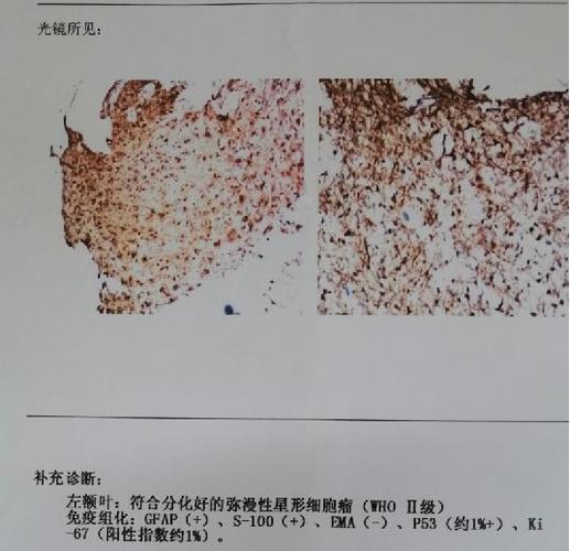 gfa（gfap阳性的含义）