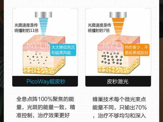 激光有辐射吗（皮秒激光有辐射吗）