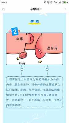 钢门（钢门有坠胀感是怎么回事）