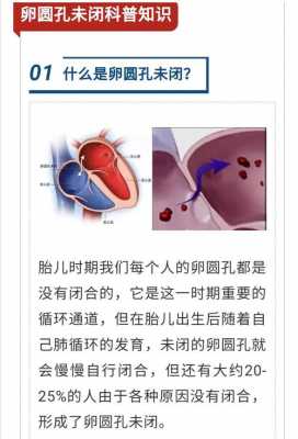 圆孔（圆孔未闭合有什么影响）