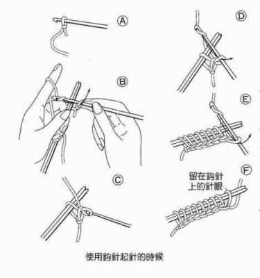 起针（起针法）