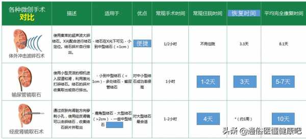 结石激光碎石费用（结石激光碎石费用多少）