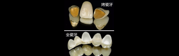 炻瓷和陶瓷哪个好（白瓷和陶瓷哪个更健康）