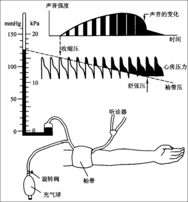 血压计原理（示波法血压计原理）